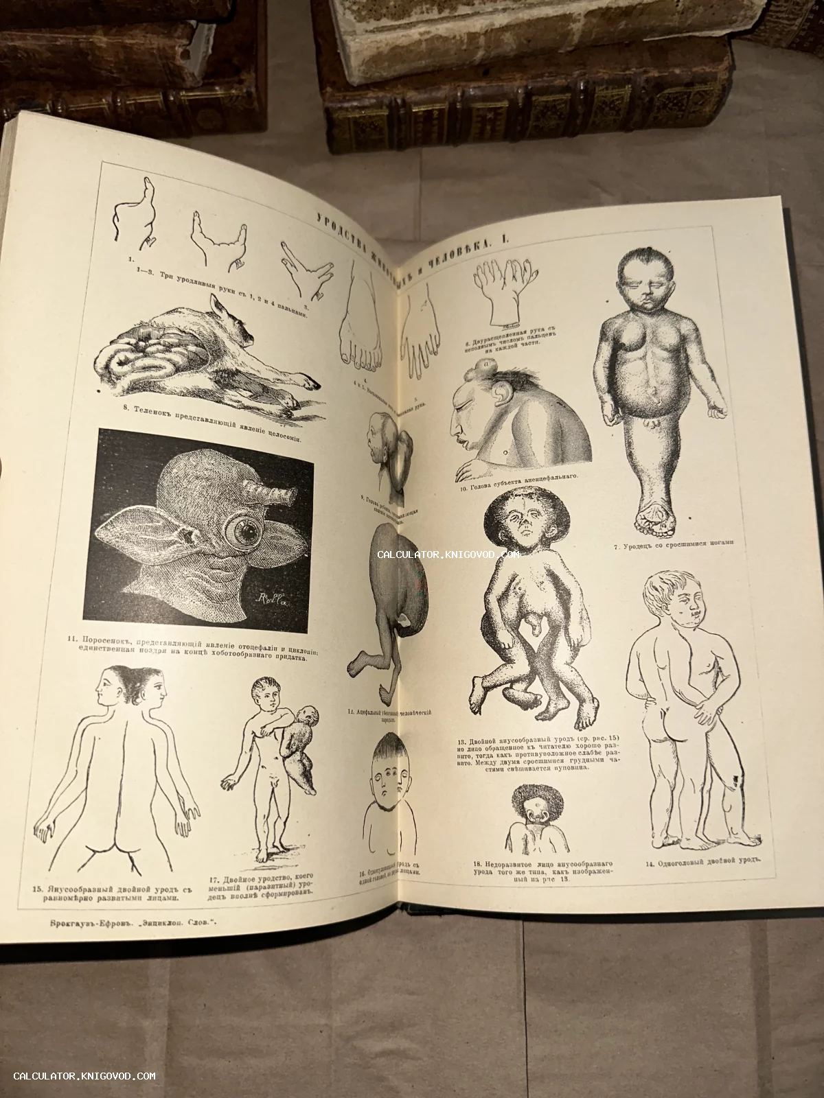 Разворот антикварной книги с черно-белыми гравюрами, изображающими различные медицинские аномалии и патологии развития плода человека и животных.