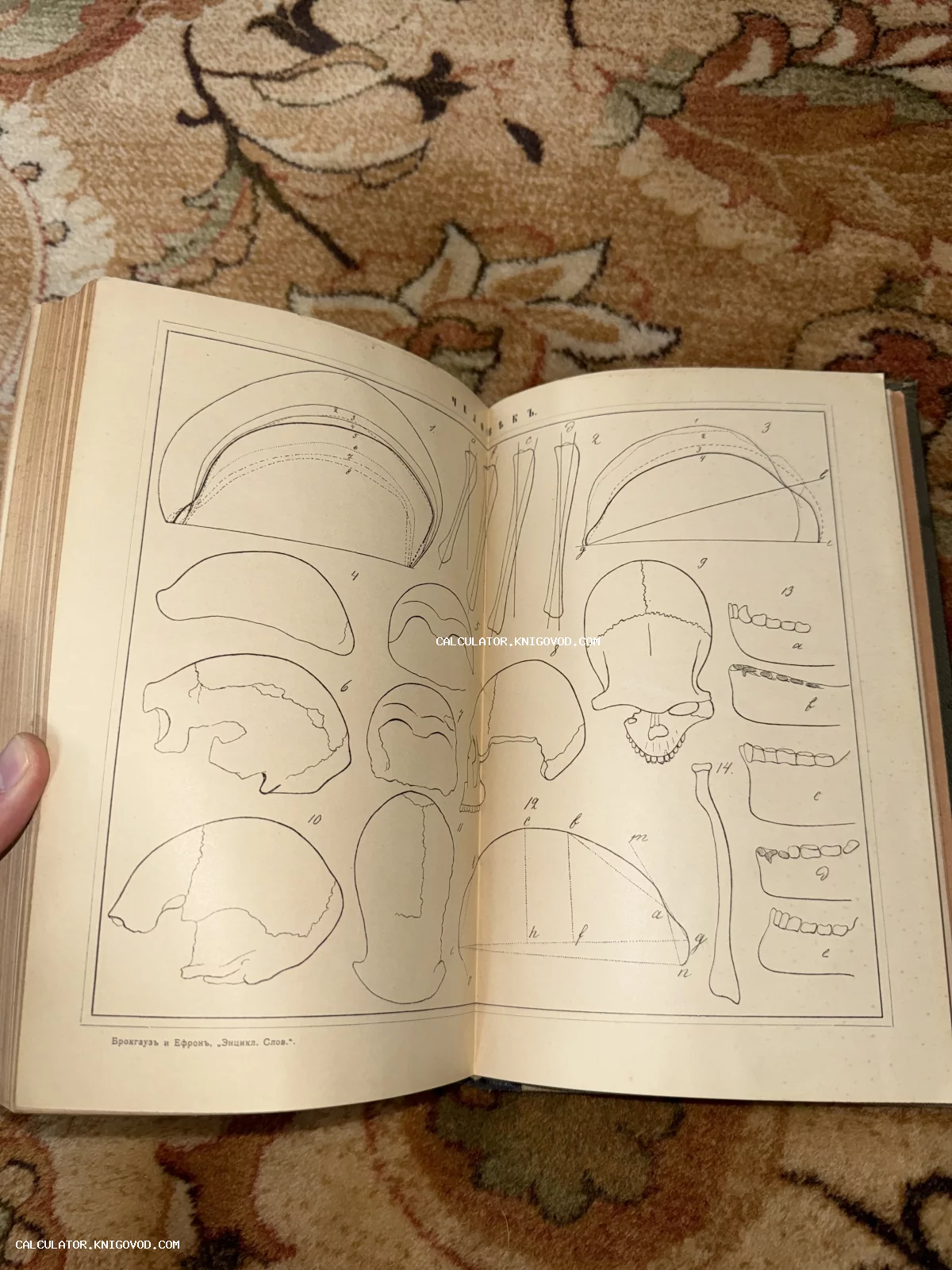 Разворот старинной книги с чертежами человеческих черепов и костей из Энциклопедического словаря Брокгауза и Ефрона.