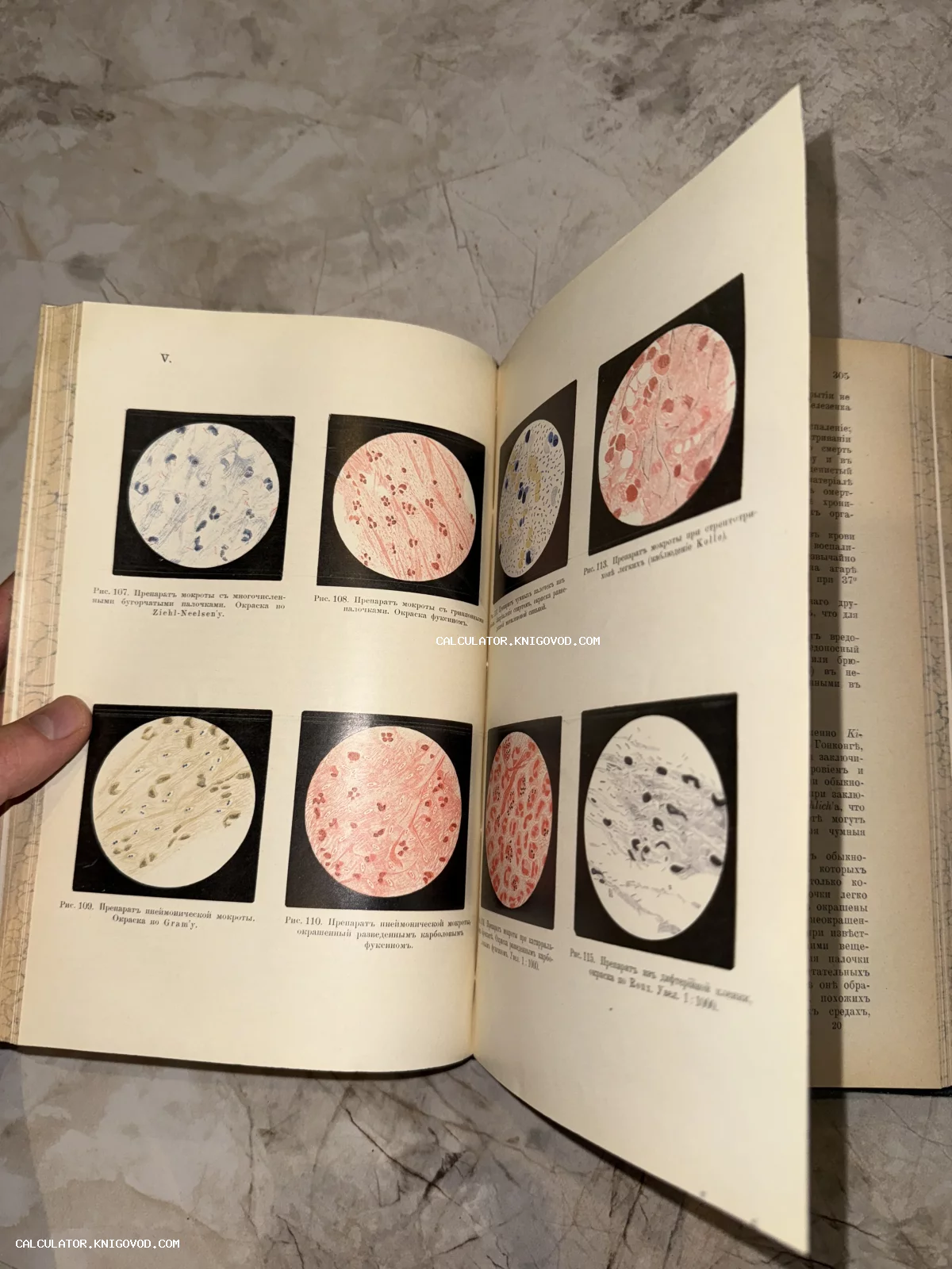 Разворот старинной медицинской книги с цветными иллюстрациями микроскопических препаратов бактерий и тканей.