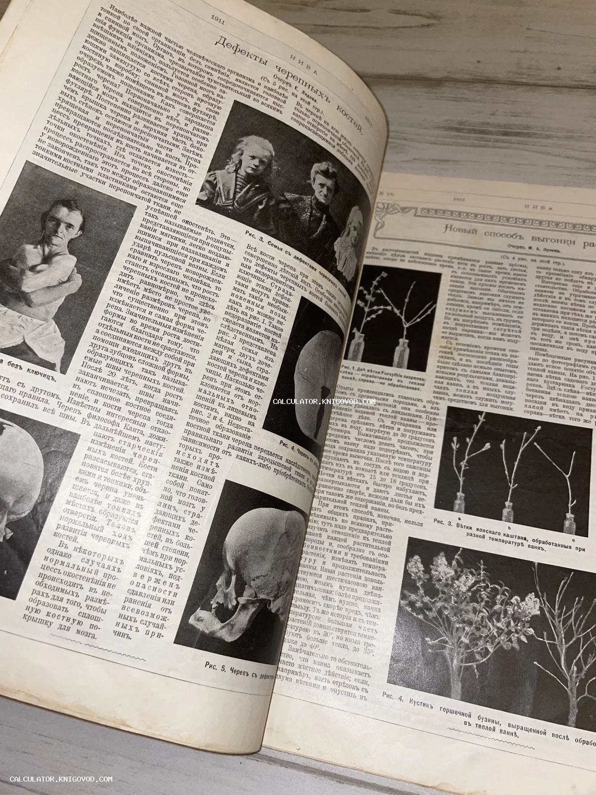 Разворот дореволюционного журнала Нива с научно-популярными статьями о дефектах костей и выращивании растений.