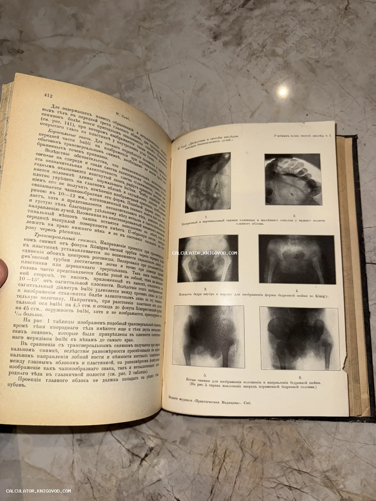 Разворот антикварной книги с текстом на дореволюционном русском языке и вклейкой с ранними рентгеновскими снимками.